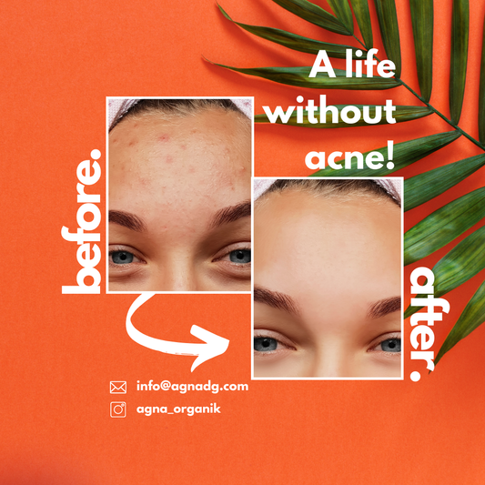 From Dull to Dazzling: Transform Your Skin with Agna’s Exfoliating Loofah Soap in the UK